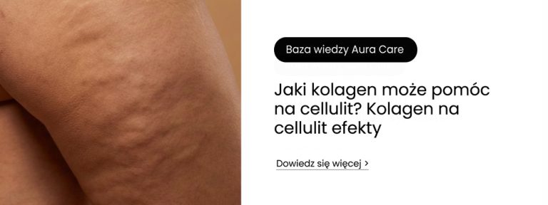 Jaki kolagen może pomóc na cellulit? Kolagen na cellulit efekty